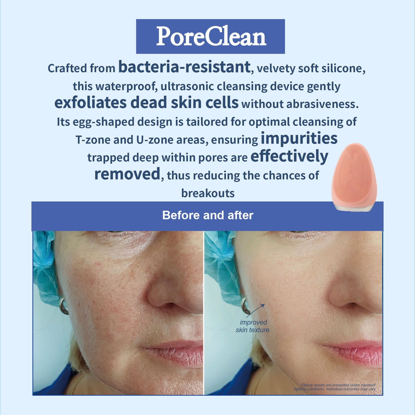 Poreclean